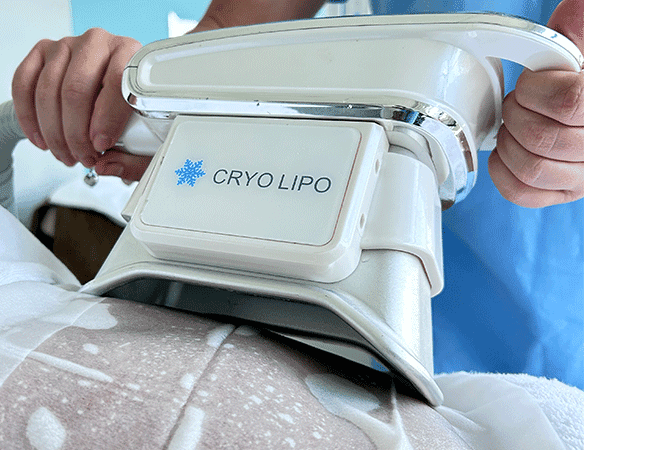 Cryolipolysis